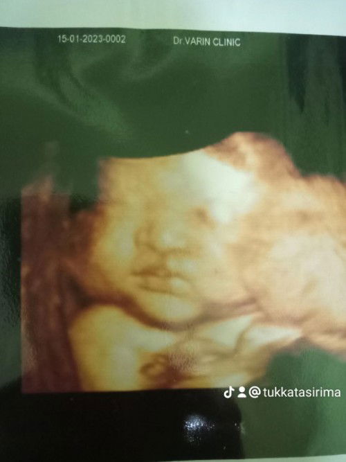 คันอวัยวะเพศขณะตั้งครรภ์