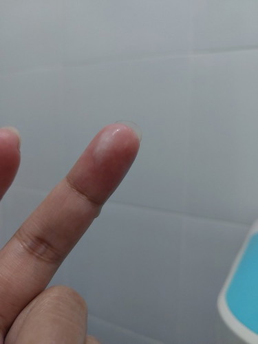 Hello po..Ok lang po ba ang ganitong discharge??3 months preggy po ako at madami po akong