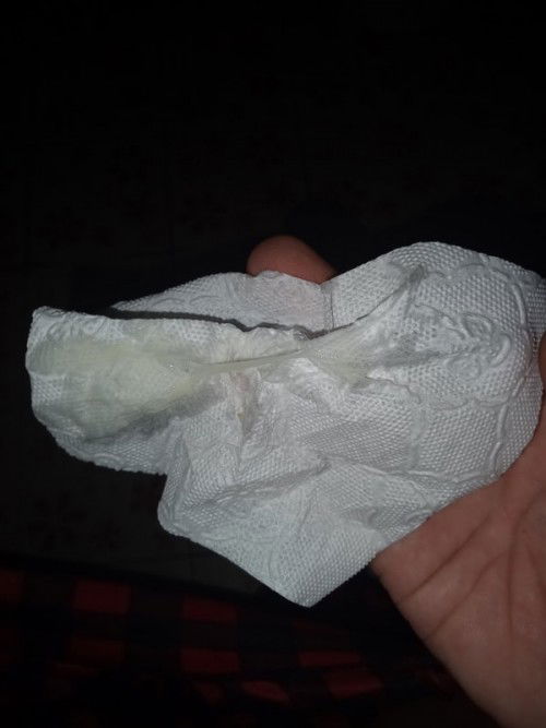 ใช่มูกขาวไหมคะ