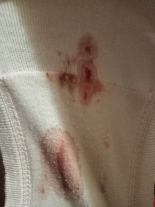 SPOTTING OR MENS NA PO?