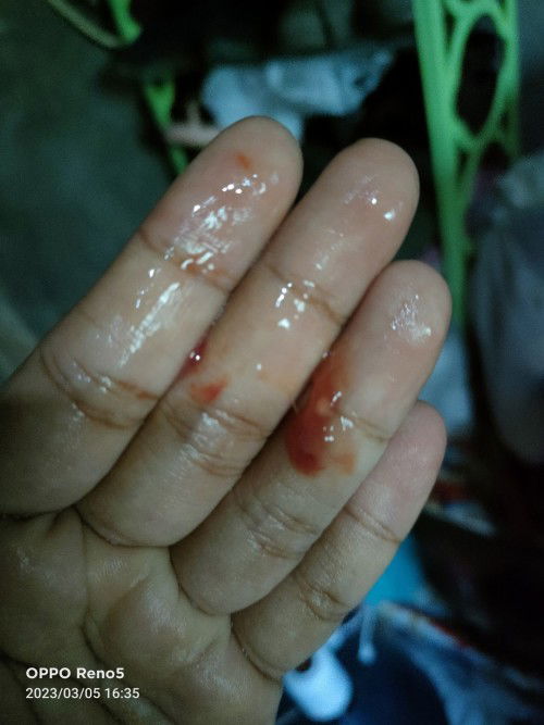 Keluar lendir& darah