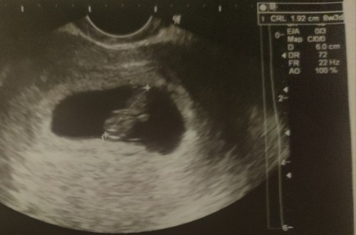 Gender 8 weeks