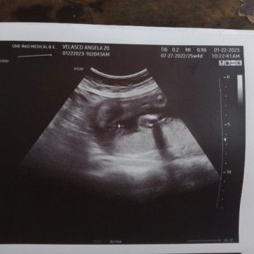 Ano Po sa tingin nyo Girl napo kaya yan??