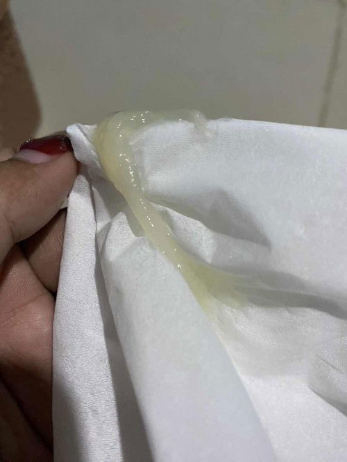 Lendir dikehamilan 38weeks