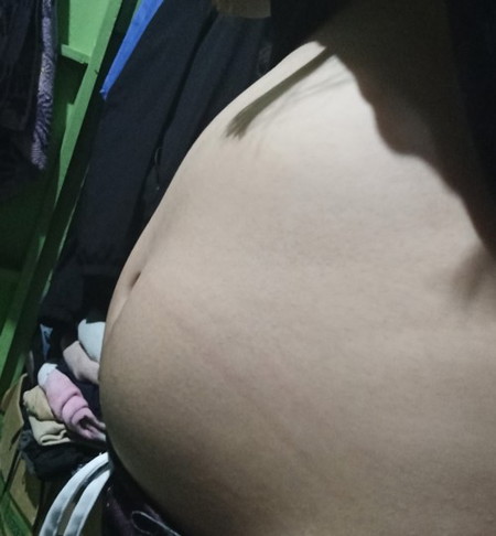 Malaking tiyan kahit 10weeks palang