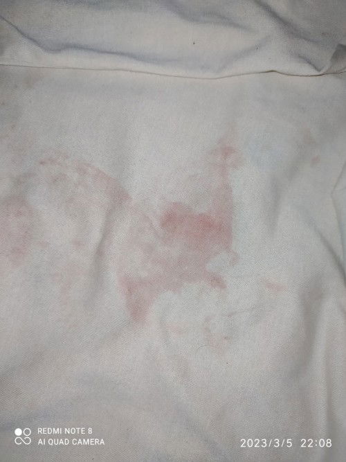 Bun sya haid dri tgl 2 tpi drah gk byak, drahnya kyk foto aja ini knpa ya bun, mohon info & sarannya