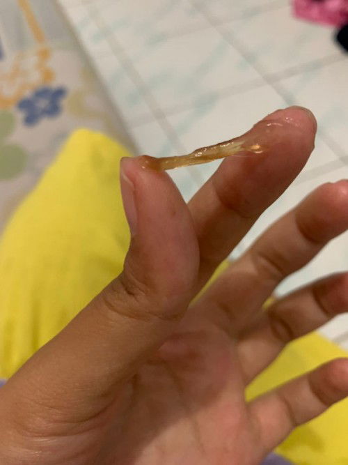 Permisi Bun mau nanya, maaf ini jorok ya
Sy td pagi habis berenang skrg ini habis bak ini apa ya bun