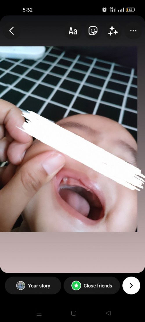 Ngipin po ba ito mga mamsh? Bat sa gilid po? Hehe