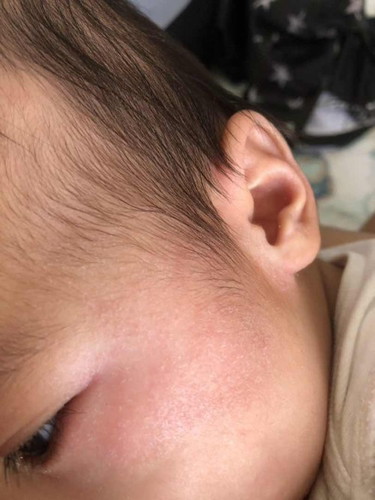 Skin irritation? Skin disease?