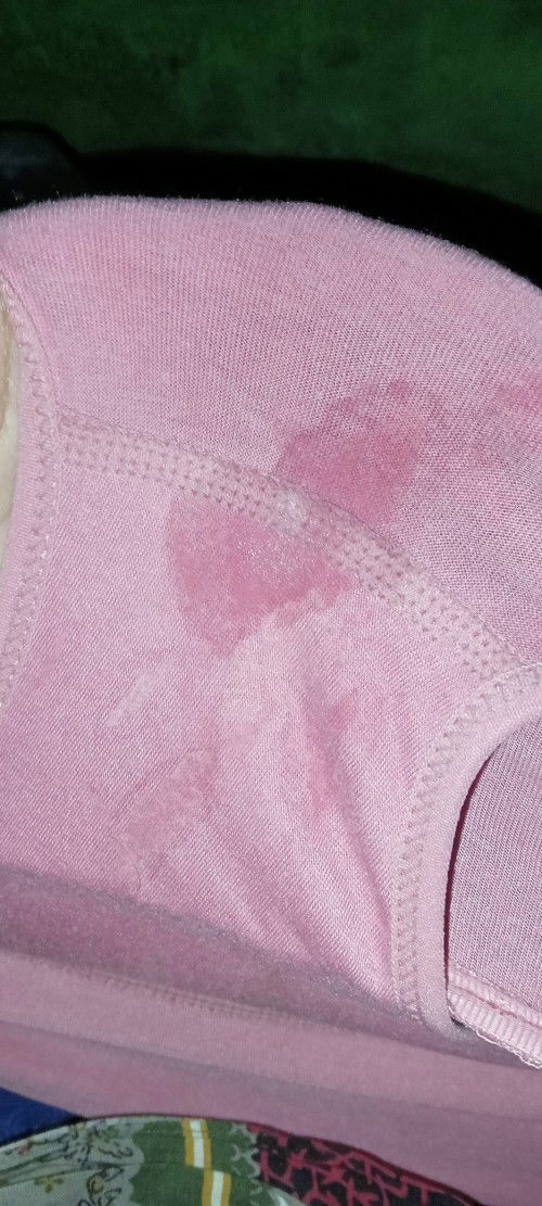 Air ketuban rembes atau keputihan