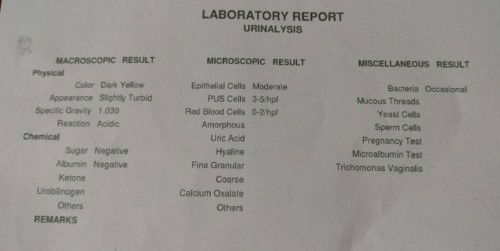 Normal lang ba sumakit ang puson?