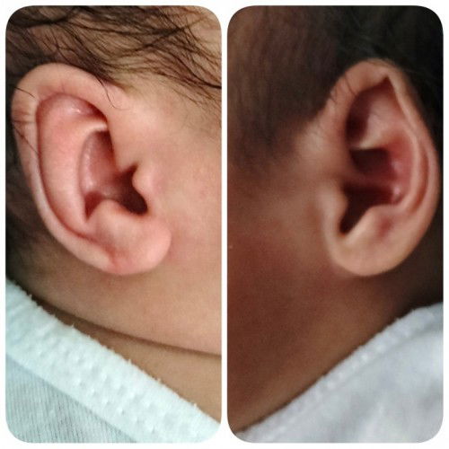 Magkaiba Ang hugis Ng tenga