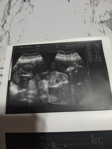 Normal din po ba na si baby malikot at matakaw ka talaga kahit na baby girl ang anak mo?