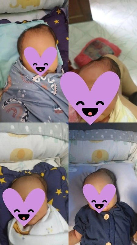 bun apakah kepala bayi kaya gini akan hilang dgn sendirinya?