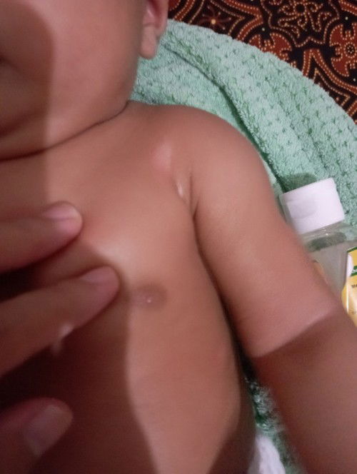 Bercak putih di badan bayi