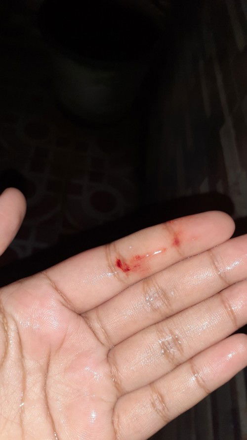 8 Minggu keluar flek