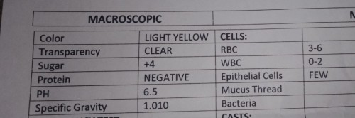 Sugar sa Urinalysis Test