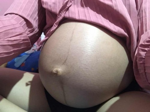 สอบถามค่ะแบบนี้น้องใกล้คลอดยังค่ะ
36 Week 3 Day