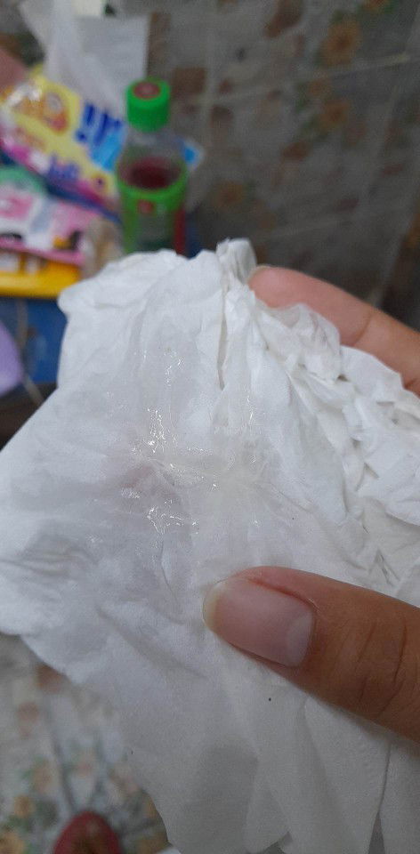 27+5วีค มีมูกแบบนี้ปกติไหม