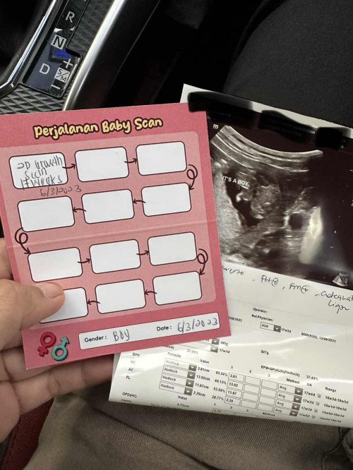 Hi, pernah tak terang camni Boy tapi keluar girl? Hehe saje je tanya pengalaman2.