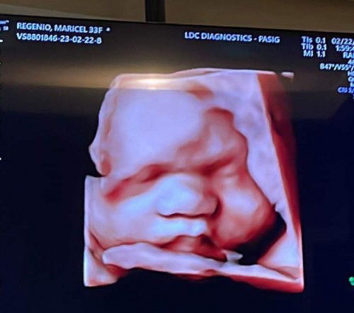 So cute ng aming Baby Boy ❤️