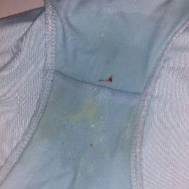 Udah muncul tanda rembes dan darah tapi tidak ada kontraksi