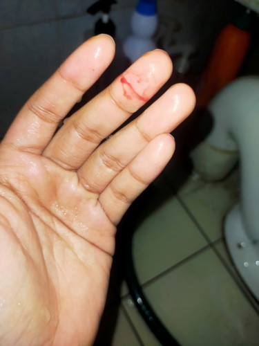 Ada sesiapa pernah dengar hamil kosong @ tak menjadi?