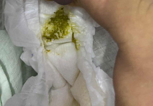 warna najis baby newborn