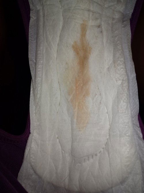 UK 38w 4d Keluar Flek Darah .. HPL 17 MARET 2023