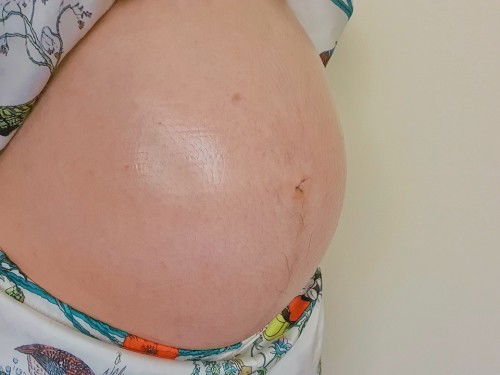 ใครกำหนดคลอด12มีนาคมแล้วยังไม่แตกบ้างเอ่ย