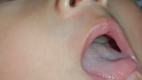 Lidah bayi