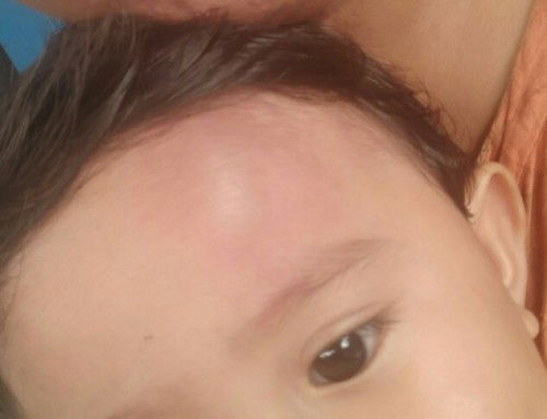 Anak jatuh dari kasur