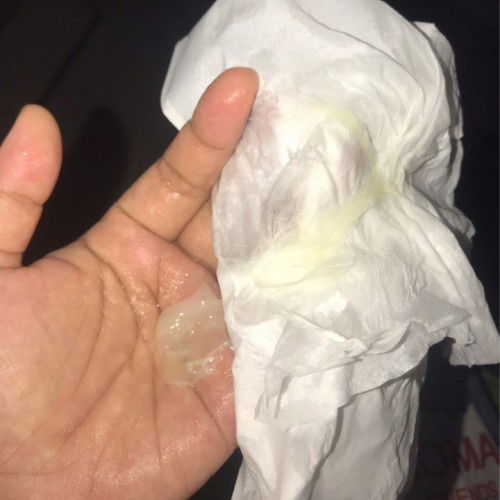 Masi di php 37 week 1 day