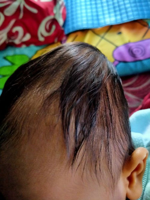 Sharing masalah bayi