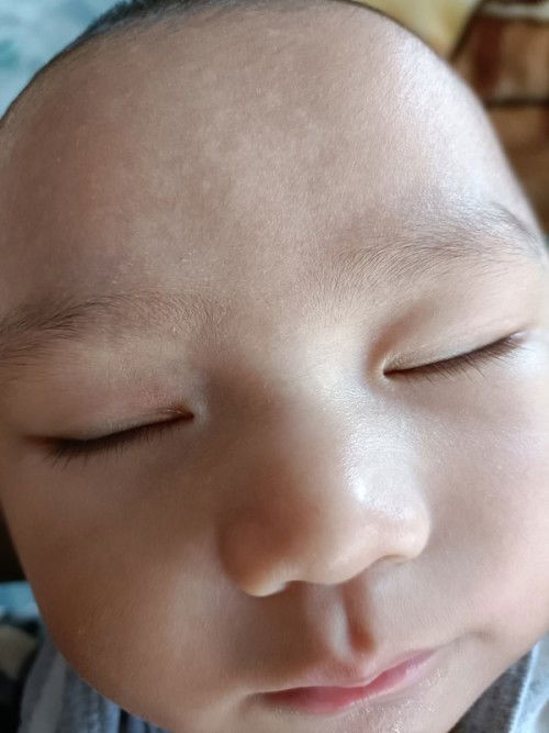 หน้าผากลูกเป็นวงขาวๆ