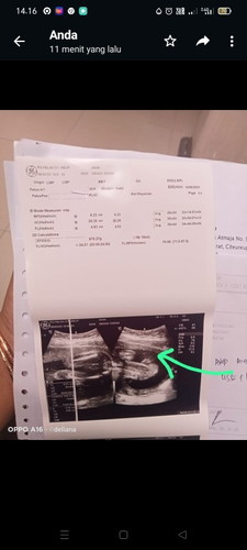 Bun itu yang saya tandaiin sebuah kanan apa ya Bun kan kepala yang sebelahnya ya itu apa ya