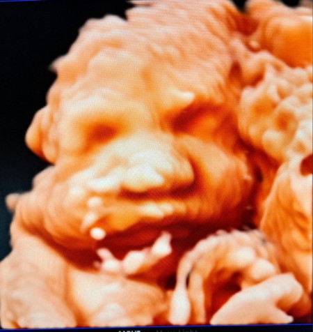 32weeks baby boy