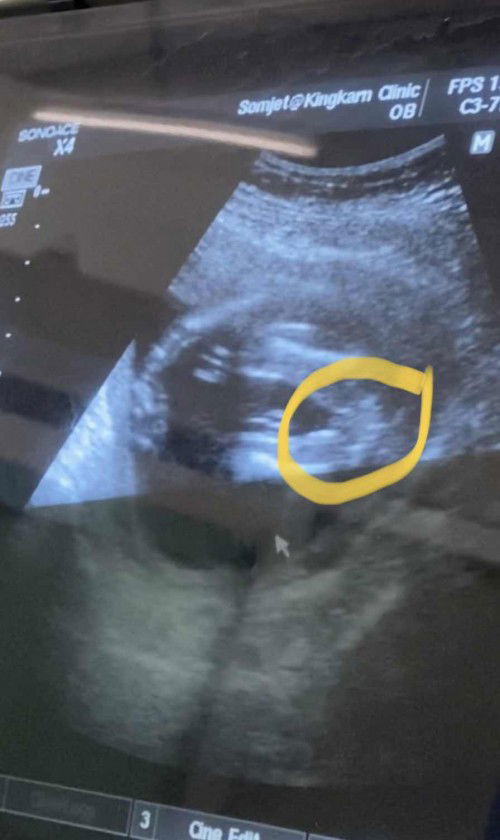 ญ หรือ ช จ้าาาาา