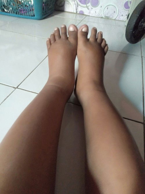 Bun ada ga si disni yg kaki nya bengkak kea saya usia 38week, bnyak yg blng hrus kurangi garem,