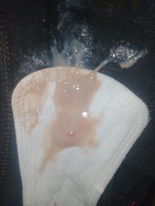 37weeks nako tomorrow mga mi plssss help pooooo