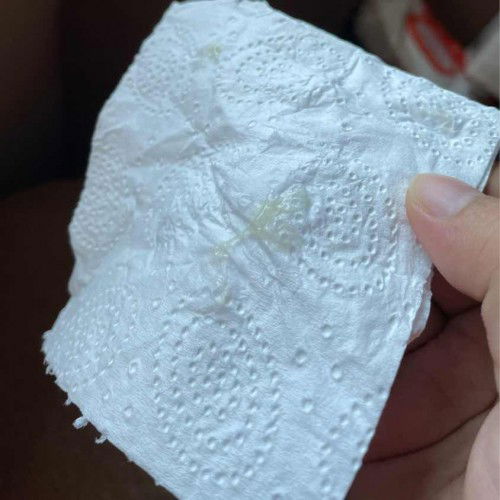 Asking about discharge