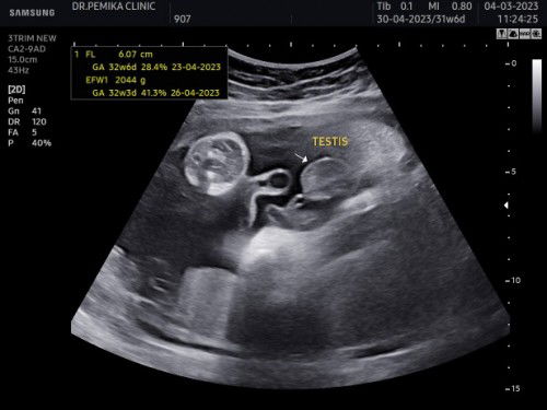 แม่ๆบ้านไหนเจอเหตุการณ์แบบนี้บ้างคะ จากหญิงเป็นชาย