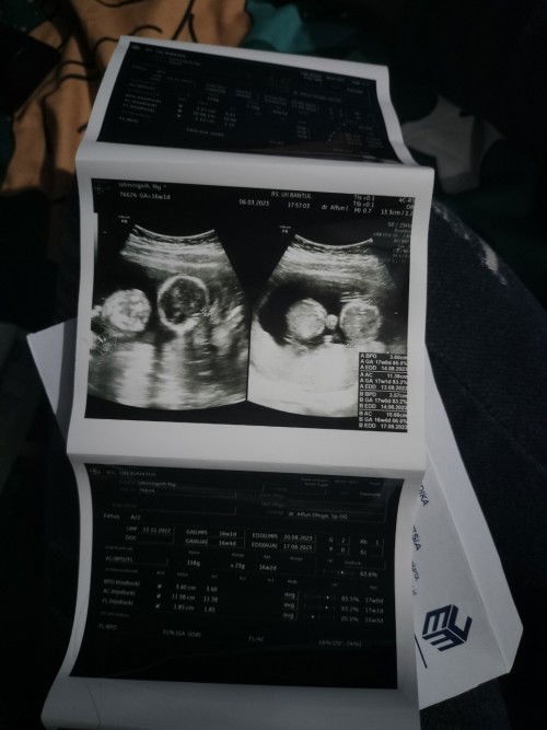 usia kehamilan 16 minggu