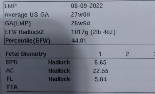 timbang ni baby @ 30 weeks