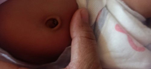 Mag ask lang po mga mie Yun pusod ni babyq dry na po talaga Ngayon,peo my maliit pa naiwan!