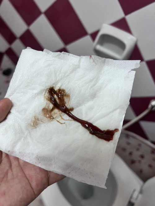 ตรวจปากมดลูกแล้วมีเลือดออก