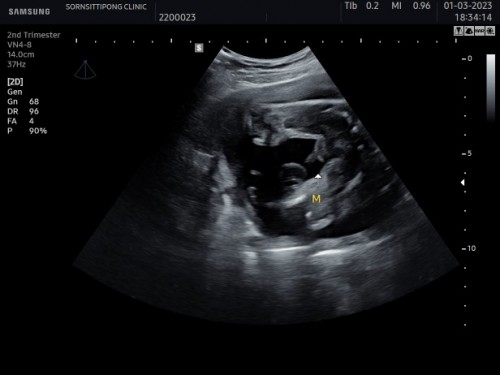 สอบถามหน่อยคะ