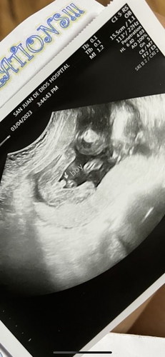 PELVIC ULTRASOUND!