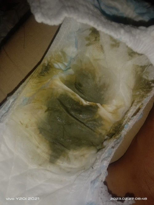 pasintabi po sa lahat .mga mommy Normal lang po ba yung ganitong poop ni baby 3months na po siya