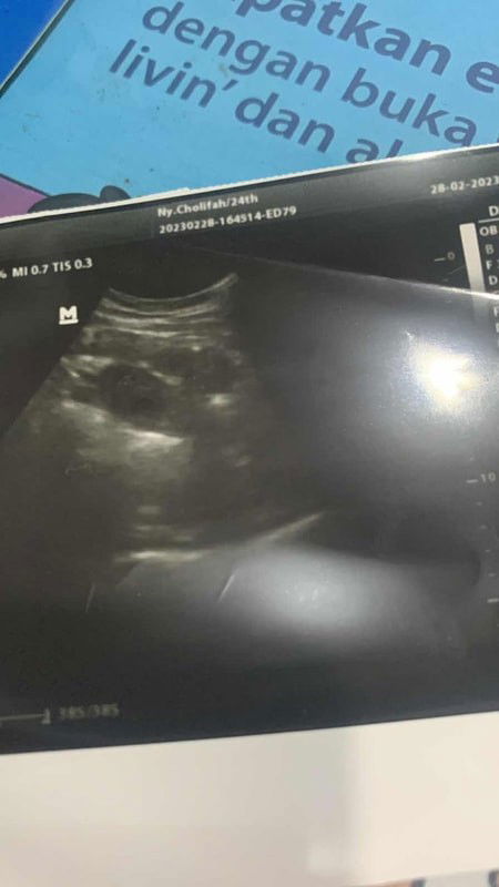 Ini ada berapa kantong ya bun